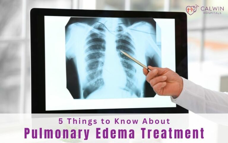 Pulmonary Edema Treatment Symptoms Causes Diagnosis