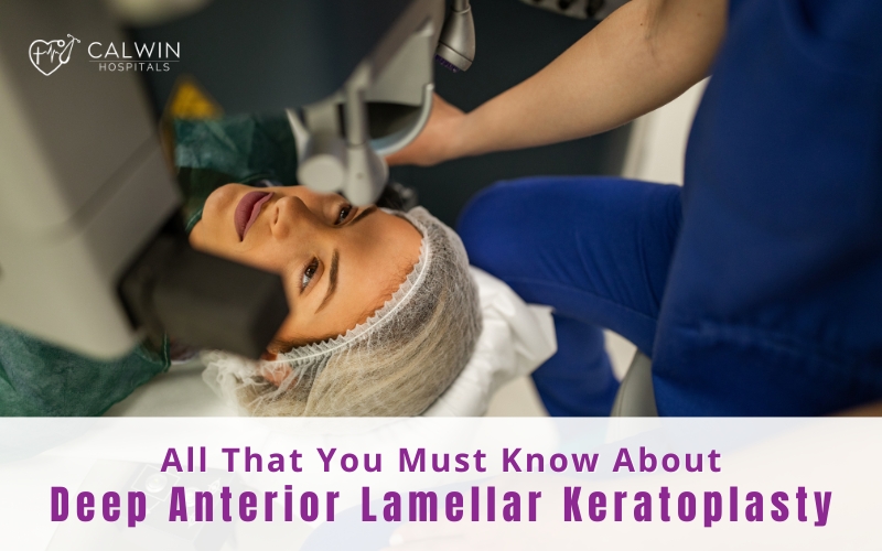 About Deep Anterior Lamellar Keratoplasty